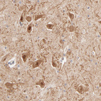 Anti-TXNL1 Antibody