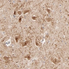 Immunohistochemical staining of human hippocampus shows moderate nuclear and cytoplasmic positivity in neurons.