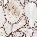 Immunohistochemical staining of human Thyroid gland shows strong cytoplasmic and nuclear positivity in glandular cells.