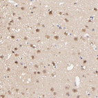 Anti-TXNL1 Antibody