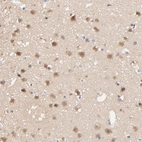 Immunohistochemical staining of human Cerebral cortex shows moderate cytoplasmic and nuclear positivity in neuronal cells.