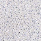 Immunohistochemical staining of human liver shows very weak cytoplasmic positivity in hepatocytes.