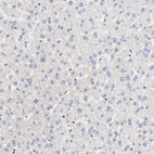 Anti-TXNL1 Antibody