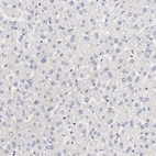 Immunohistochemical staining of human liver shows very weak cytoplasmic positivity in hepatocytes.