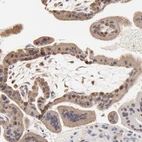 Immunohistochemical staining of human placenta shows moderate to strong nuclear and cytoplasmic positivity in trophoblastic cells.