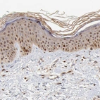 Immunohistochemical staining of human skin shows moderate to strong nuclear positivity in squamous epithelial cells.