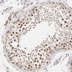 Immunohistochemical staining of human testis shows moderate to strong nuclear positivity in cells in seminiferous ducts.
