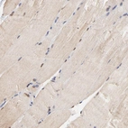 Immunohistochemical staining of human skeletal muscle shows no nuclear positivity in myocytes as expected.