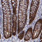 Anti-DCTPP1 Antibody