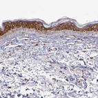 Immunohistochemical staining of human skin shows high expression.
