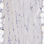 Immunohistochemical staining of human skeletal muscle shows low expression as expected.