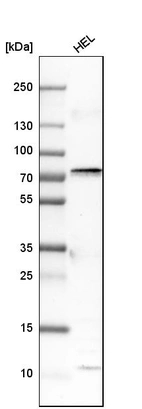 Western blot analysis in human cell line HEL.