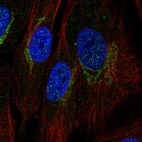 Immunofluorescent staining of human cell line BJ shows localization to the Golgi apparatus.