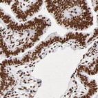 Anti-FBXO18 Antibody