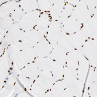 Immunohistochemical staining of human skeletal muscle shows strong nuclear positivity in myocytes.