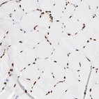 Immunohistochemical staining of human skeletal muscle shows strong nuclear positivity in myocytes.