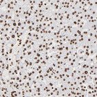 Immunohistochemical staining of human liver shows strong nuclear positivity in hepatocytes.