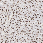 Immunohistochemical staining of human liver shows strong nuclear positivity in hepatocytes.