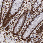 Immunohistochemical staining of human rectum shows strong nuclear positivity in glandular cells.