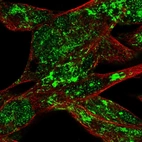 Immunofluorescent staining of human cell line RH-30 shows localization to nucleoli fibrillar center & mitochondria.