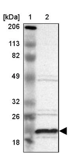 Lane 1: Marker [kDa] 206, 113, 82, 49, 32, 26, 18_br/_Lane 2: Human cell line RT-4