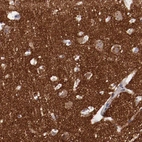 Immunohistochemical staining of human cerebral cortex shows strong positivity in neuropil.