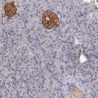 Immunohistochemical staining of human pancreas shows moderate cytoplasmic positivity in islets of Langerhans.