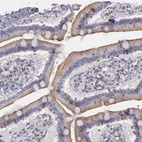 Immunohistochemical staining of human duodenum shows moderate cytoplasmic positivity in enteroendocrine cells.