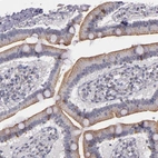 Immunohistochemical staining of human duodenum shows moderate cytoplasmic positivity in enteroendocrine cells.