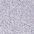 Immunohistochemical staining of human liver shows no cytoplasmic positivity in hepatocytes as expected.