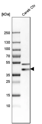 Western blot analysis in human cerebral cortex tissue.