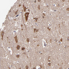 Immunohistochemical staining of human cerebral cortex shows moderate to strong cytoplasmic positivity in neurons.