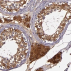Immunohistochemical staining of human testis shows moderate to strong cytoplasmic positivity in cells in seminiferous ducts.