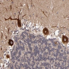Immunohistochemical staining of human cerebellum shows moderate to strong cytoplasmic positivity in Purkinje cells.