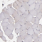 Immunohistochemical staining of human skeletal muscle shows no positivity in myocytes as expected.