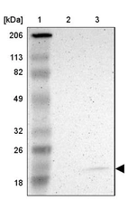 Lane 1: Marker [kDa] 206, 113, 82, 49, 32, 26, 18_br/_Lane 2: Human cell line RT-4_br/_Lane 3: Human cell line U-251MG sp