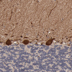 Anti-FRMD8 Antibody