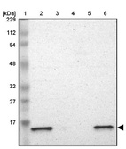 Lane 1: Marker [kDa] 229, 112, 84, 48, 32, 27, 17_br/_Lane 2: Human cell line RT-4_br/_Lane 3: Human cell line U-251MG sp_br/_Lane 4: Human plasma (IgG/HSA depleted)_br/_Lane 5: Human liver tissue_br/_Lane 6: Human tonsil tissue