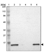 Anti-ATP5D Antibody