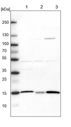 Anti-ATP5D Antibody