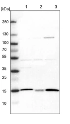 Lane 1: NIH-3T3 cell lysate (Mouse embryonic fibroblast cells)_br/_Lane 2: NBT-II cell lysate (Rat Wistar bladder tumour cells)_br/_Lane 3: PC12 cell lysate (Pheochromocytoma of rat adrenal medulla)