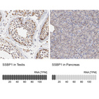 Anti-SSBP1 Antibody