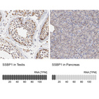 Anti-SSBP1 Antibody