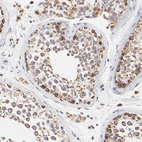 Immunohistochemical staining of human testis shows positivity in cells in seminiferous ducts.