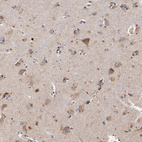 Anti-SSBP1 Antibody