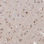 Immunohistochemical staining of human cerebral cortex shows granular cytoplasmic positivity in neurons.