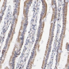 Immunohistochemical staining of human duodenum shows granular cytoplasmic positivity in glandular cells.
