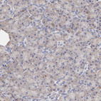 Anti-SSBP1 Antibody