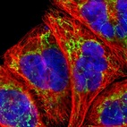 Immunofluorescent staining of human cell line A-431 shows localization to mitochondria.