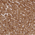 Anti-SDHB Antibody